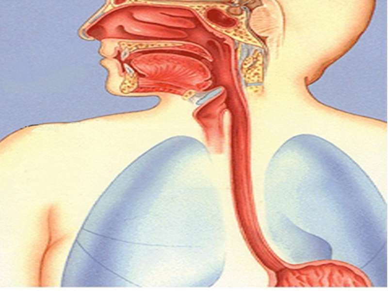 Esophageal Webs - Hình ảnh minh họa